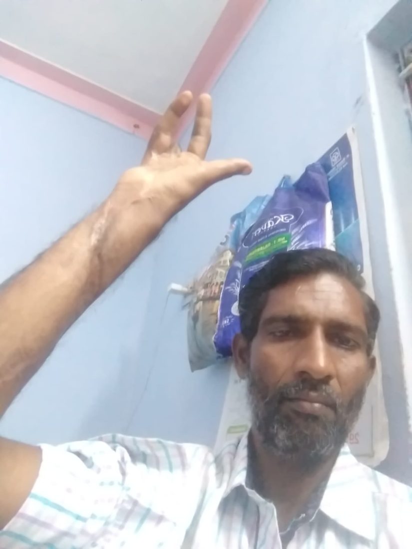 Rice and medical supplies for a man whose hand was disabled by injury.